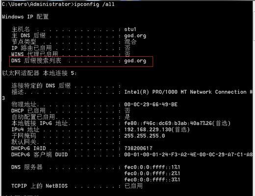 如何查看本机IP和DNS服务器地址（快速了解并查找本机IP和DNS服务器地址的方法）